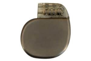 Implantable Pulse Generator