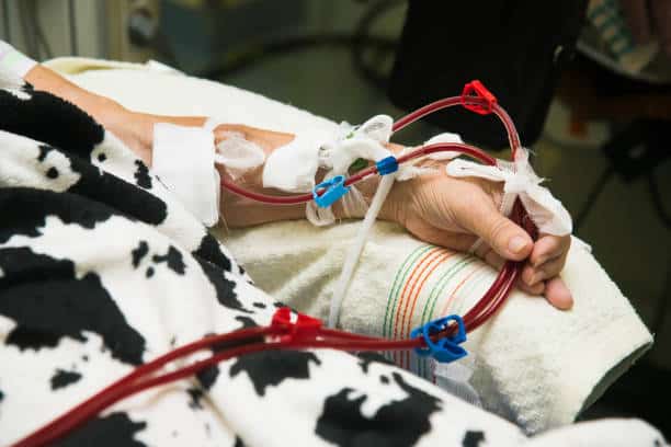 Leukapheresis