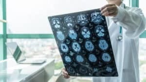 Nuclear Medicine