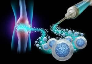 Regenerative Medicine