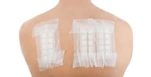 Rotigotine transdermal patches