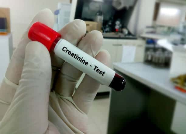 Creatinine Test