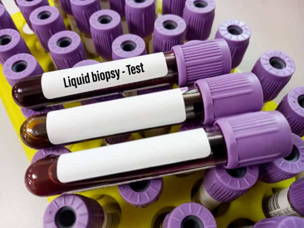 Liquid Biopsy