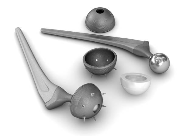Radial Head Resection Implants