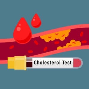 u61-Cholesterol-Testing-Services