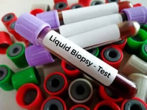 u61-Liquid-Biopsy