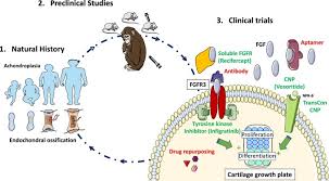 Achondroplasia Treatment Market Market Report Forecasts Dynamic Growth Through 2035