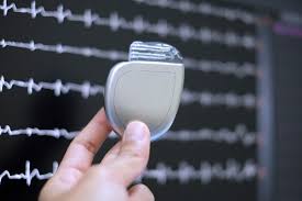 u61-Implantable-Drug-Device