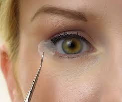 Ophthalmology-Amniotic-Membranes