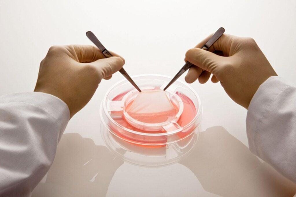 The Global Tissue Engineered Skin Substitutes Market is projected to reach USD 5.2 billion by 2030