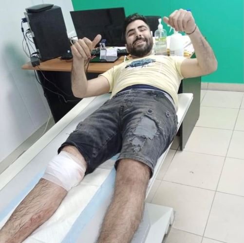 جريح في جبل محسن بشظية قذيفة صاروخية أطلقها مجهول 1 جريح في جبل محسن بشظية قذيفة صاروخية أطلقها مجهول