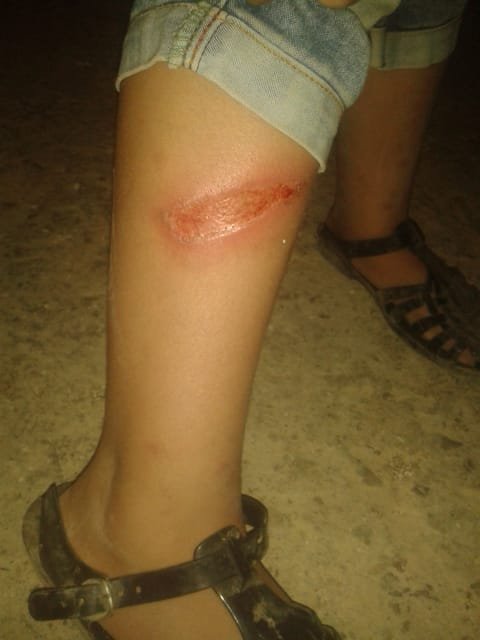 بالصور: حرق جسد ابنته امتعاضًا من ضجيجها.. اليكم مصيره