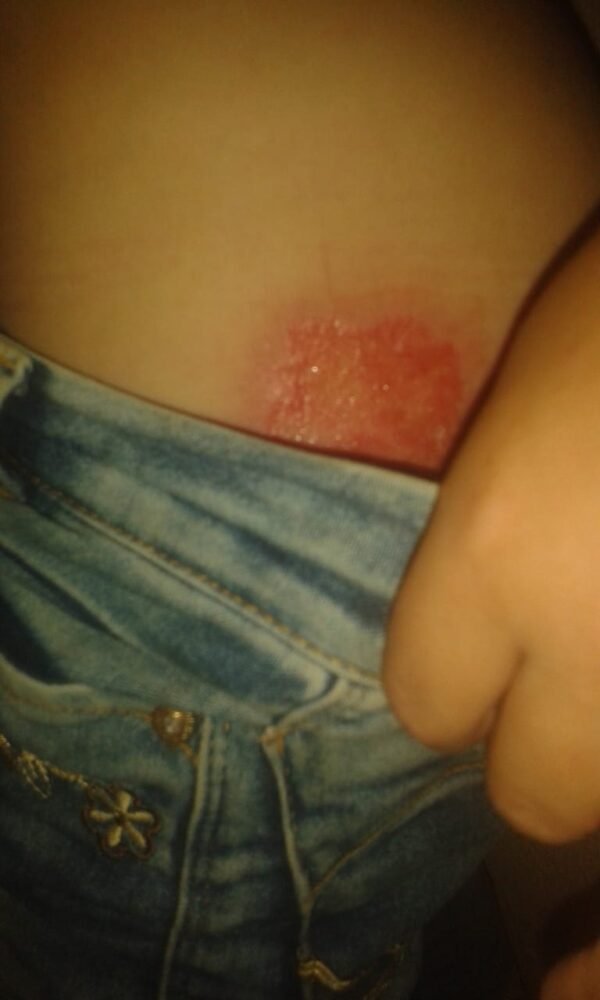 بالصور: حرق جسد ابنته امتعاضًا من ضجيجها.. اليكم مصيره