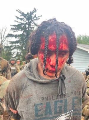 Update: Danelo Cavalcante, with visible injuries to his face (photo)