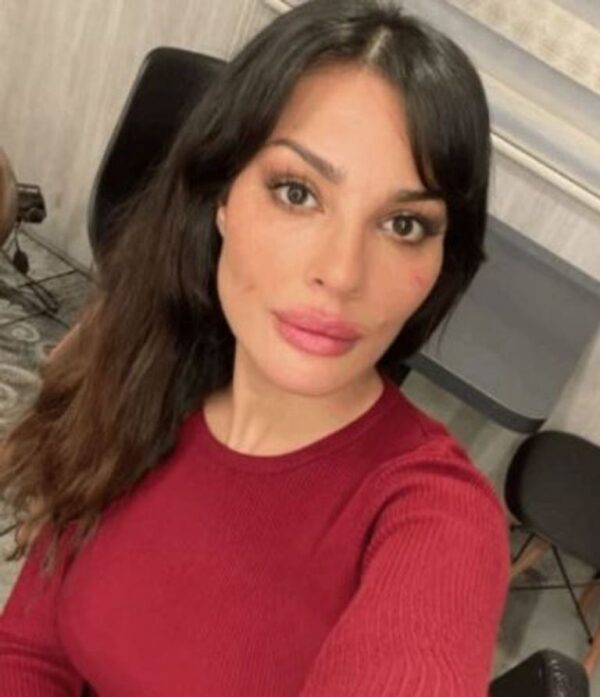 كدمات على وجه نادين نسيب نجيم تثير الجدل 1 كدمات على وجه نادين نسيب نجيم تثير الجدل