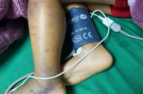 لدغة أفعى فلسطين تثير الذعر في الصوانة – مرجعيون 1 مرجعيون