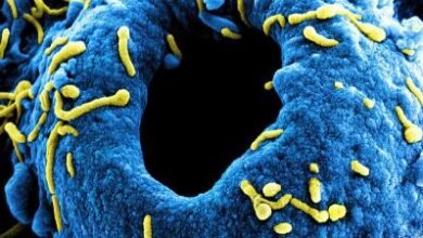 تفشّي ملبورغ في إثيوبيا يدفع لبنان لرفع التأهّب الصحي