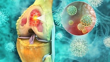 اكتشاف صادم: إنزيم مخصّص لقتل الخلايا يساعد السرطان على النجاة