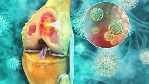 اكتشاف صادم: إنزيم مخصّص لقتل الخلايا يساعد السرطان على النجاة