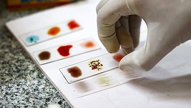 "الدم الذهبي": تعرّف على سحر فصيلة الدم الأندر في العالم #عاجل