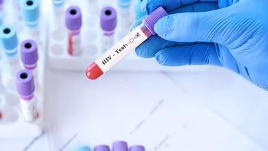 لماذا تزداد أعداد المتعايشين مع فيروس نقص المناعة في الشرق الأوسط وشمال أفريقيا وتنخفض في باقي العالم؟