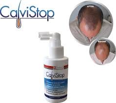 calvistop-anti-hair-loss-tonic-with-biacapil-stimulates-growth-prevents-hair-fall
