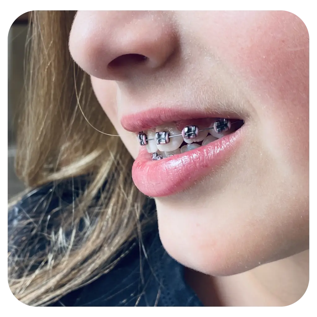 children orthodontist sydney