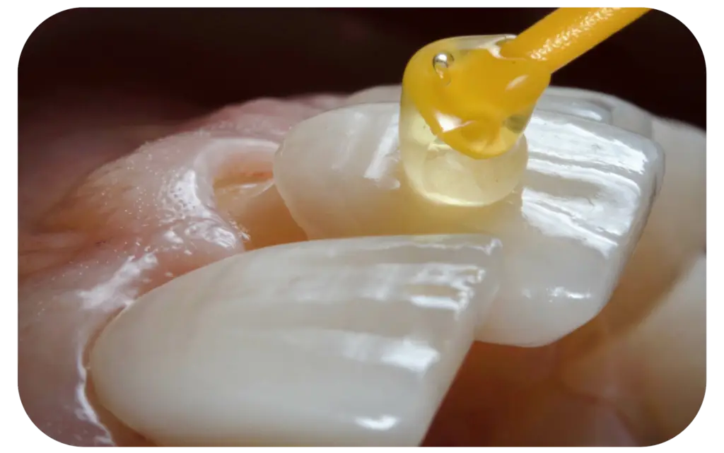 cosmetic dentist sydney cbd