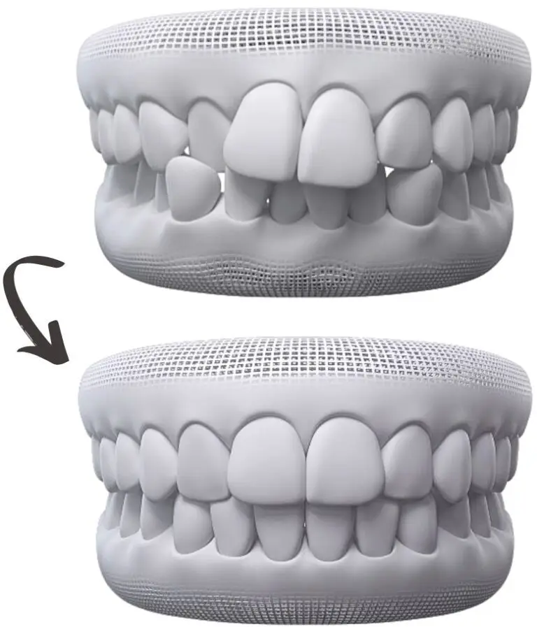 invisalign appointment sydney