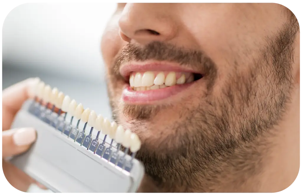 porcelain veneers near me