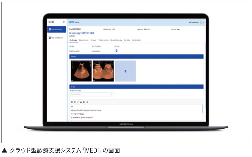 クラウド型診療支援システムの画面