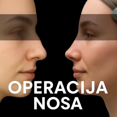 adonis hospital rhinoplasty with septoplasty