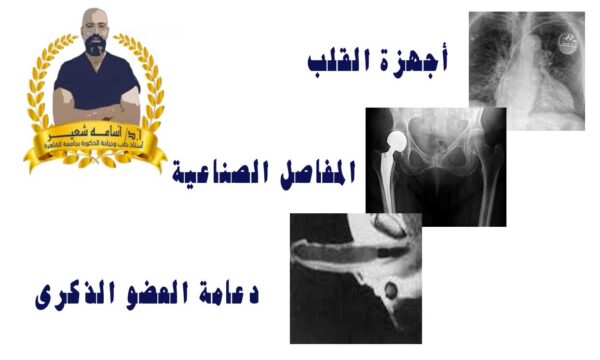 دعامة العضو الذكرى هي مختبئة بالكامل داخل القضيب و لا يتم رؤيتها