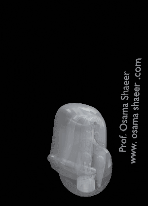 دعامة الانتصاب الهيدروليكية Inflatable Penile Implant