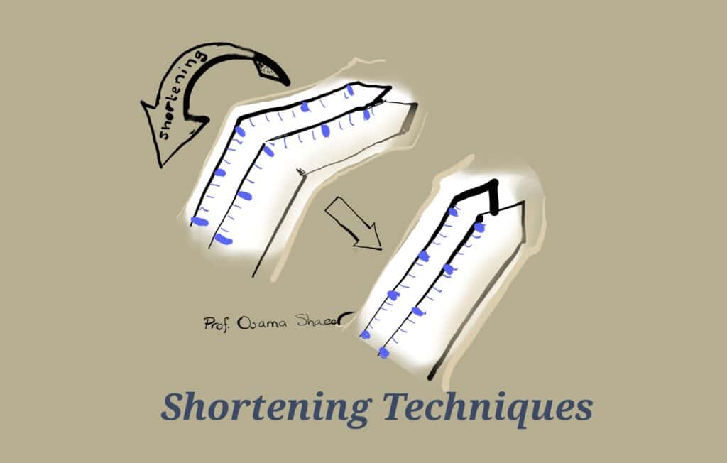 ‏إصلاح تقوس العضو الذكرى ‏بجراحة الشد العكسي
Plication for penile curvature