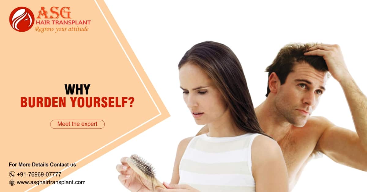 How to know if you are going bald