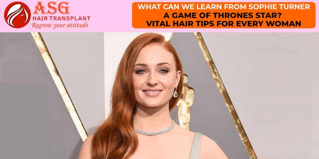 What Can We Learn from Sophie Turner- A Game of Thrones Star? Vital Hair Tips for every woman