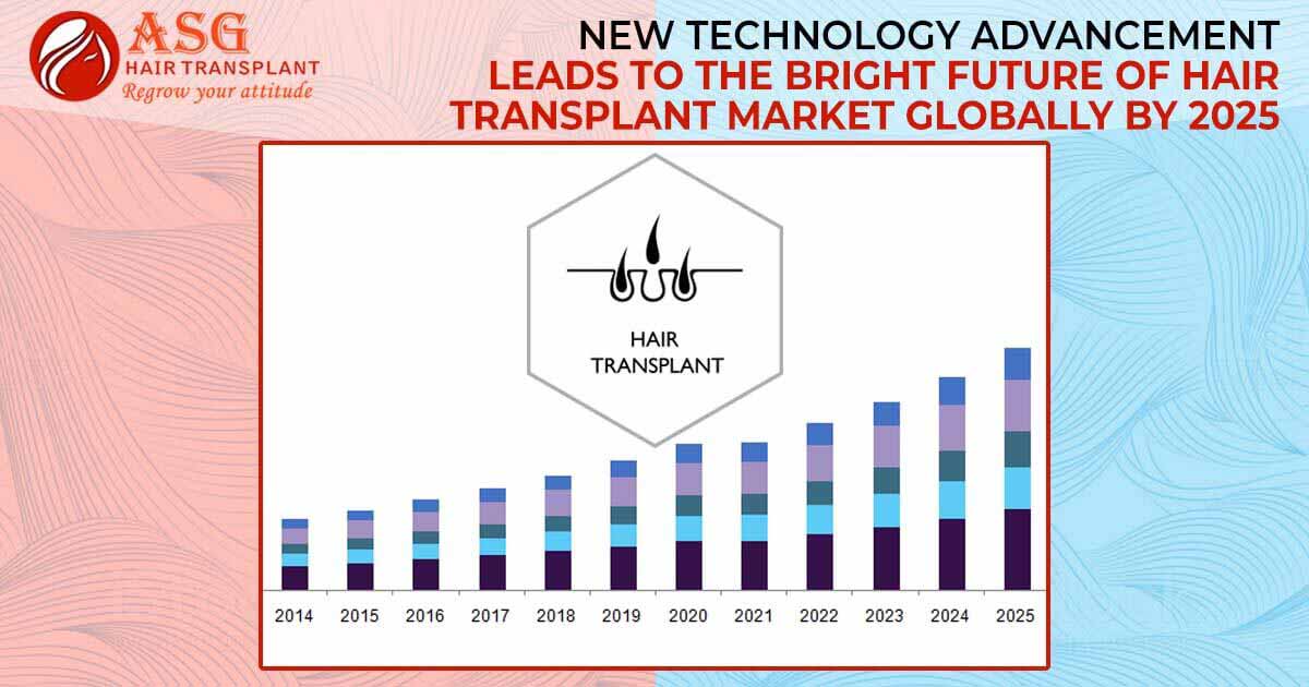 New Technology Advancement Leads To The Bright Future Of Hair Transplant Market Globally By 2025