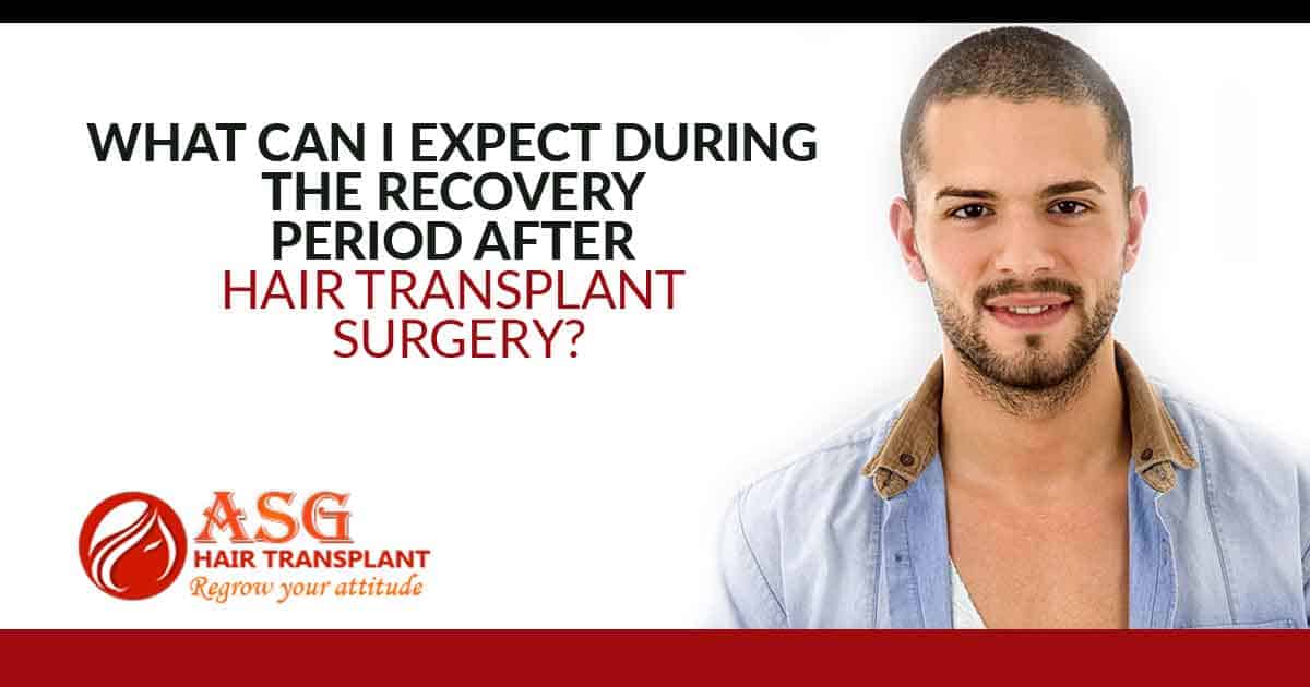 What Can I Expect During The Recovery Period After Hair Transplant Surgery?