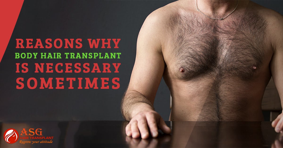 Reasons Why Body Hair Transplant is necessary sometimes