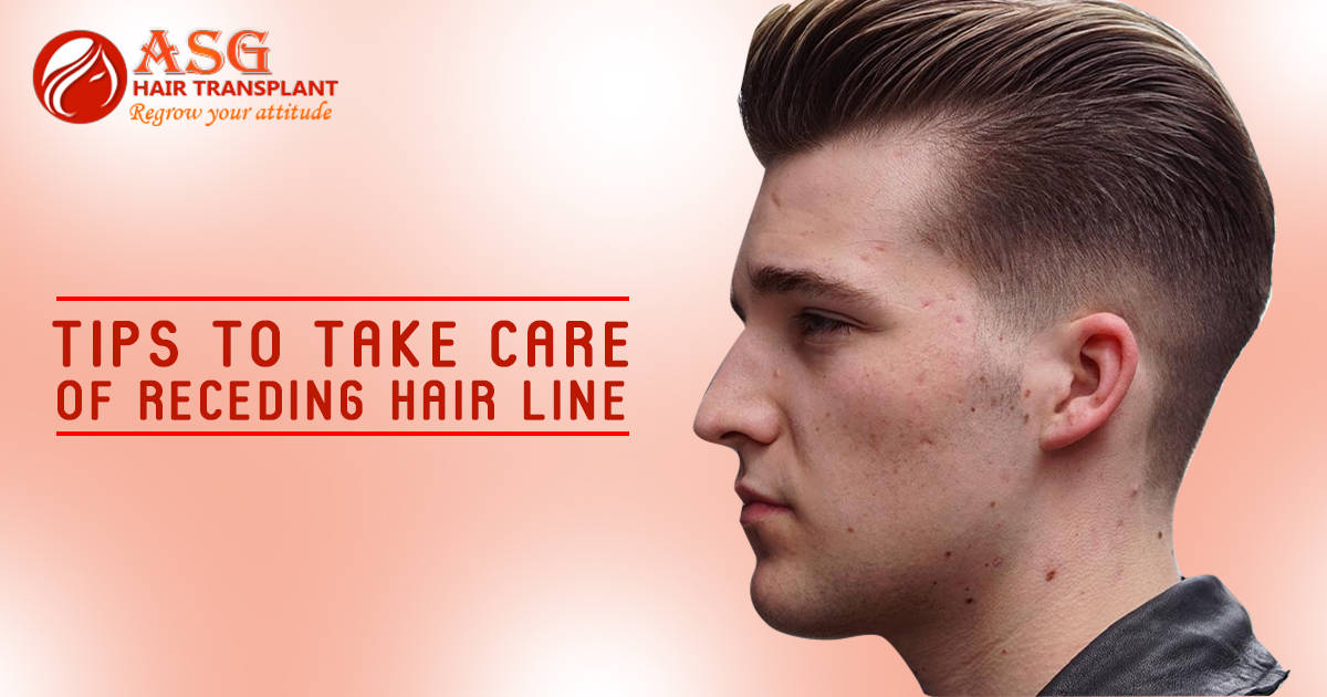 Tips to Take Care of Receding Hair line