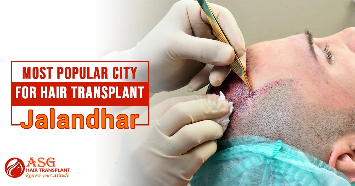 Most popular city for hair transplant Jalandhar