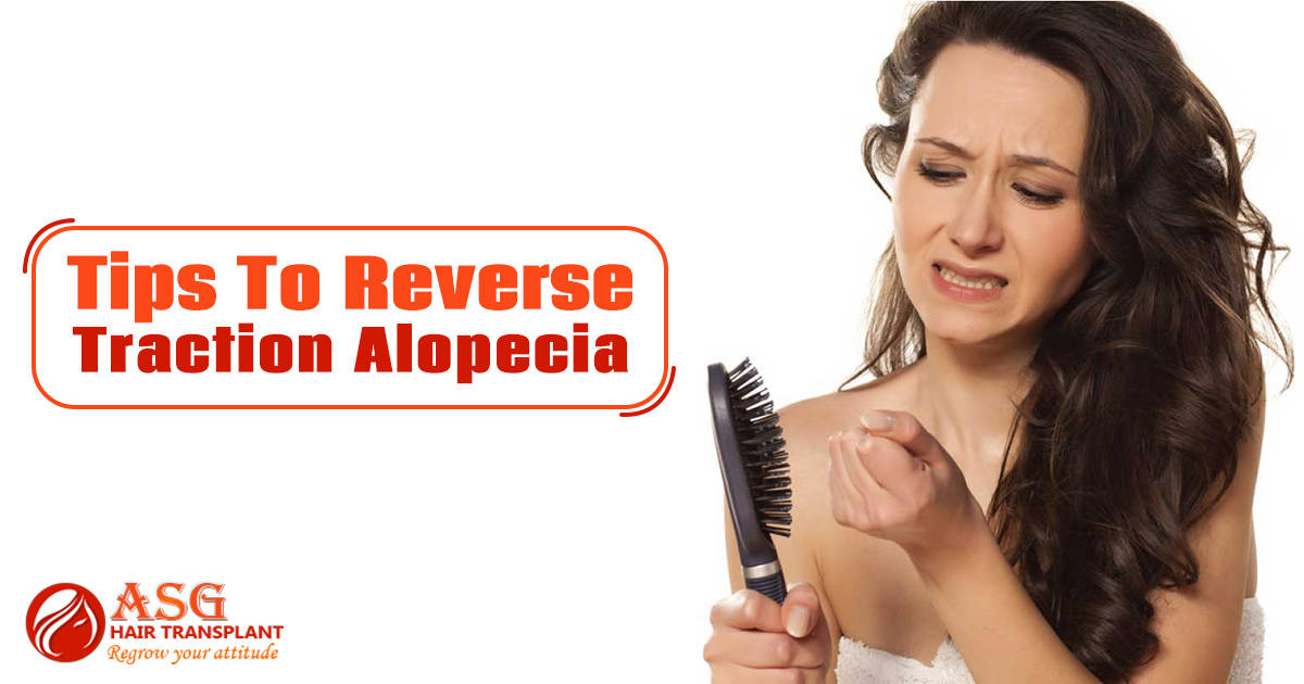Tips To Reverse Traction Alopecia