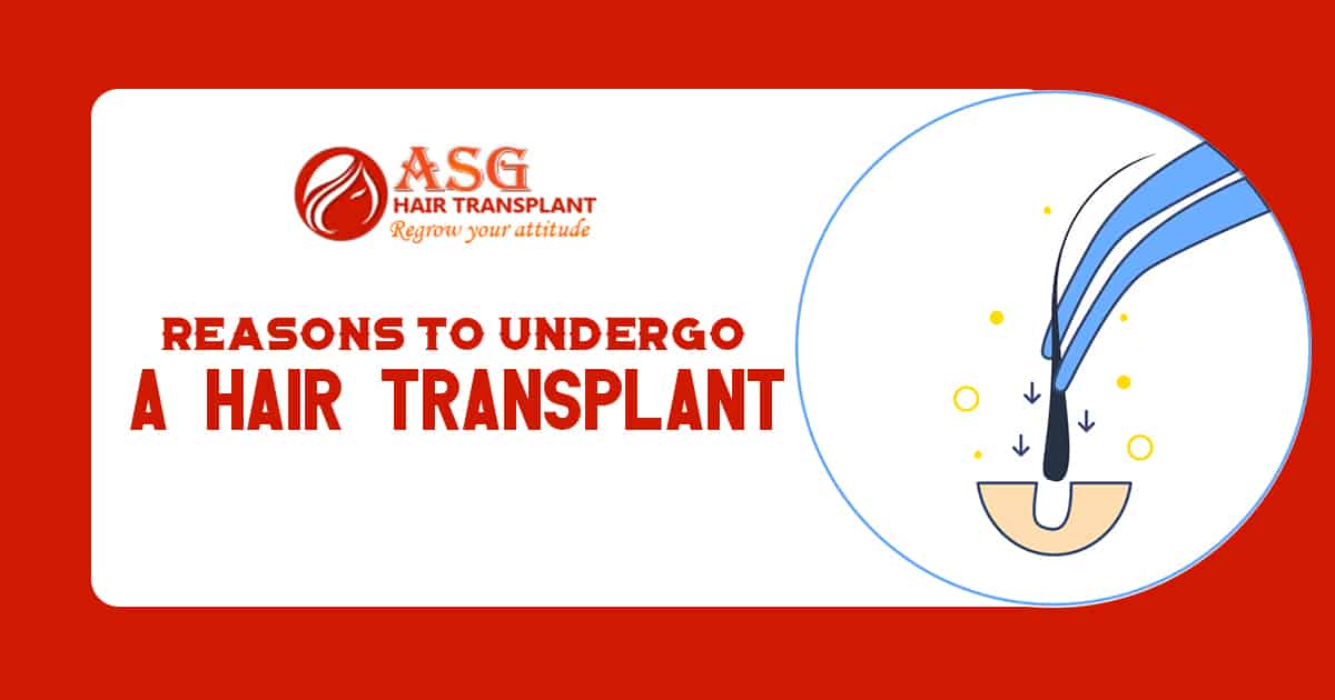 Reasons to Undergo a Hair Transplant 