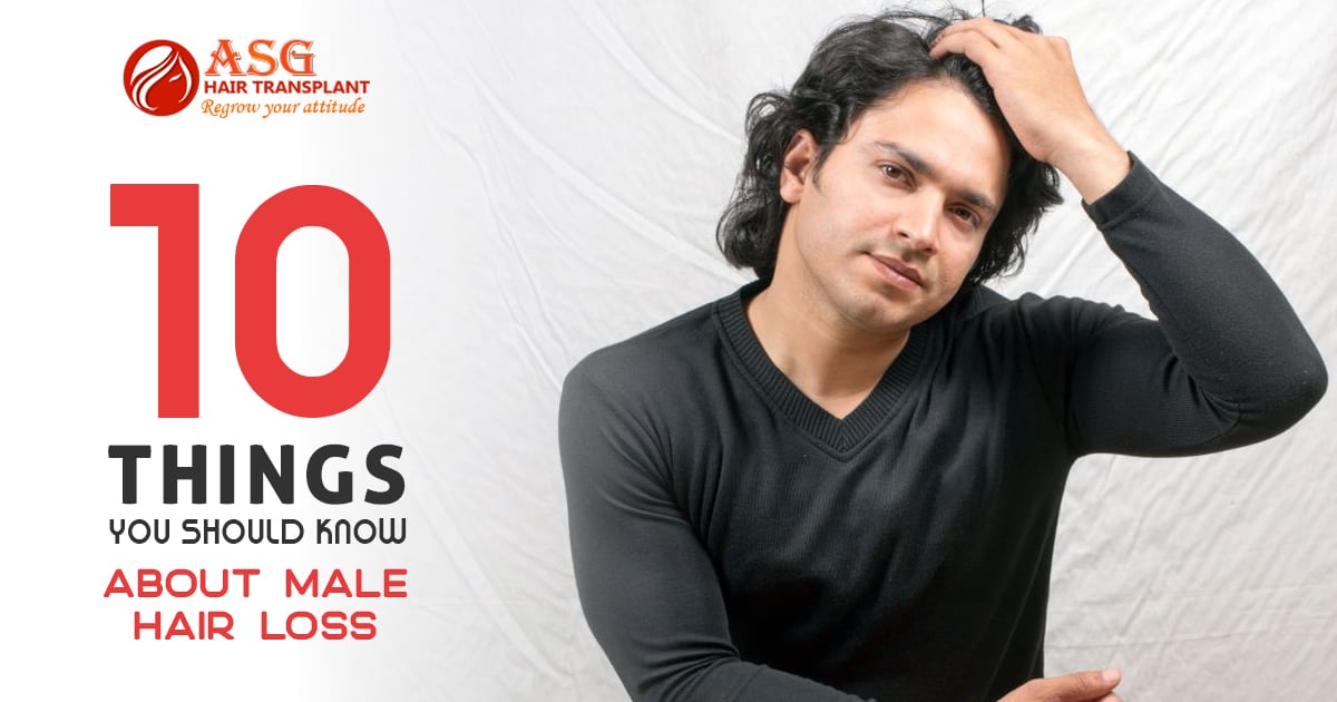 10 things you should know about male hair loss