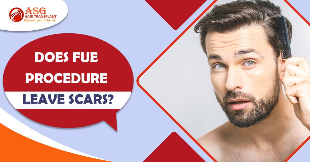 Does FUE procedure leave scars