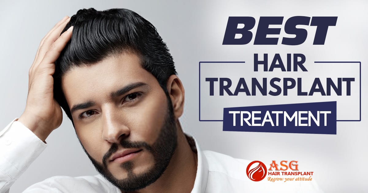 Best Hair transplant treatment