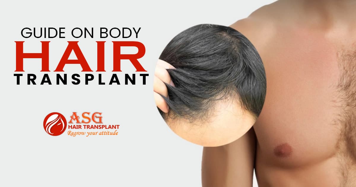 Guide on body hair transplant
