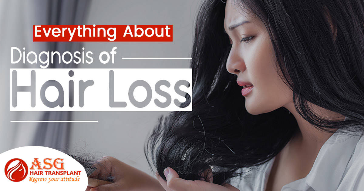 everything about the diagnosis of Hair Loss