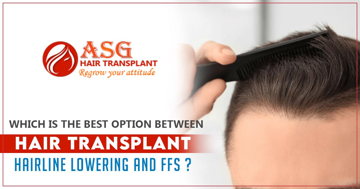 hair transplant, hairline lowering, and FFS